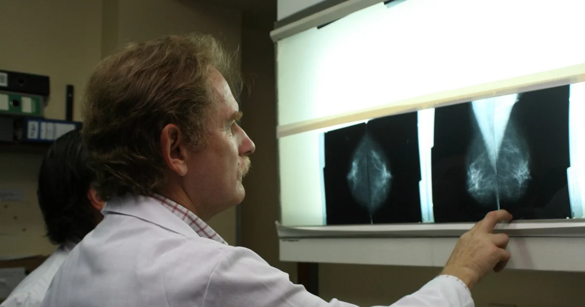 La mortalidad por cáncer de mama descendió 14% en la última década